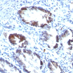 Transgelin (SM22-alpha); Clone TAGLN/247 (Concentrate)